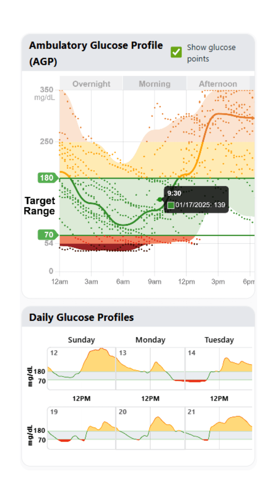 AGP and daily glucose profile on mobile